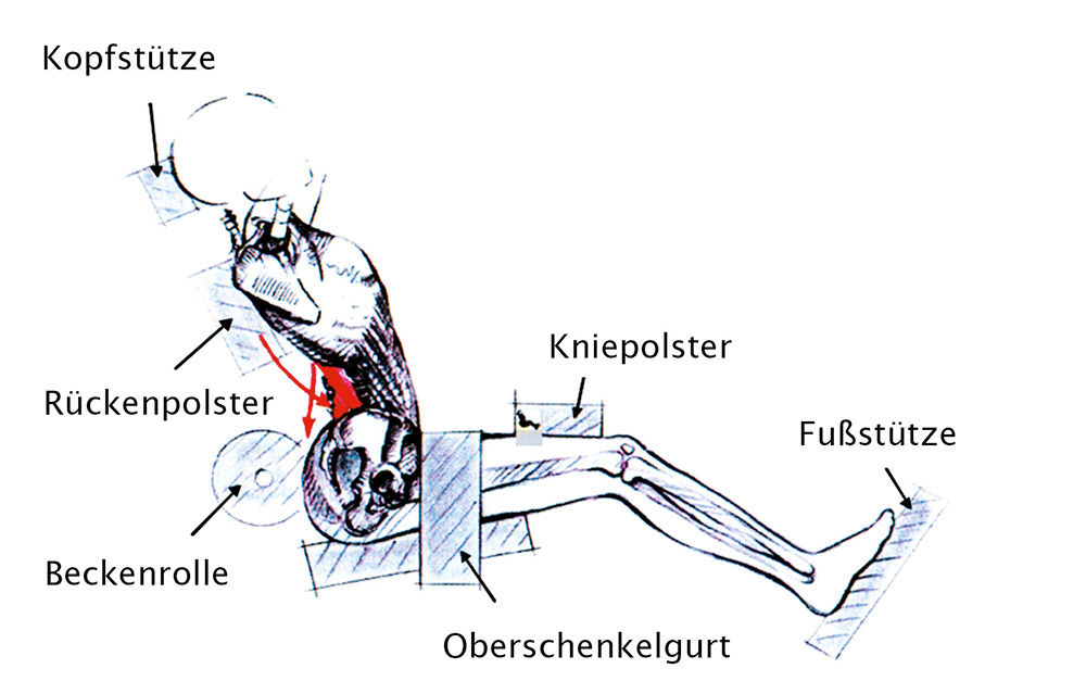 Fixierung - Behandlungsprinzip